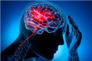 بروز سکته مغزی در مردان بیش از زنان است/ زمان طلایی درمان را جدی بگیرید